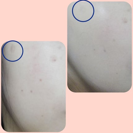 ダイレクトホワイトdeW 美白ファンデーション/pdc/化粧下地を使ったクチコミ(4枚目)