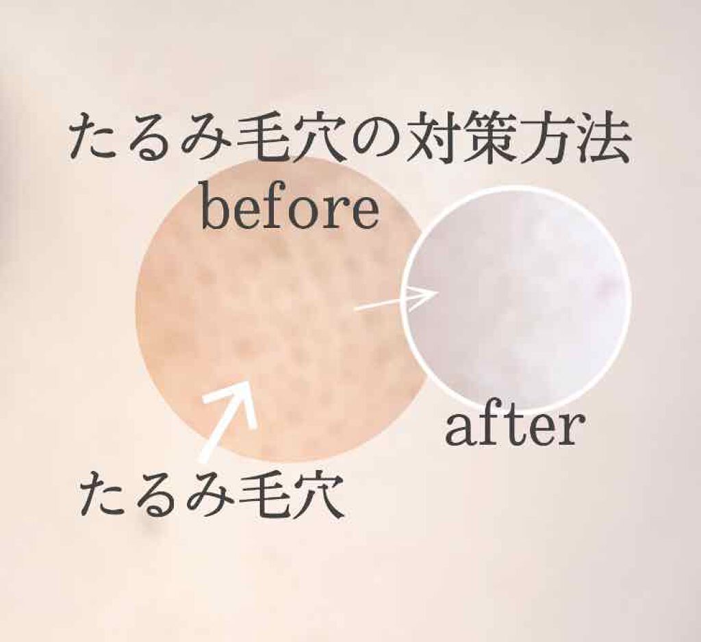  レチノールアイクリーム/THE INKEY LIST/アイケア・アイクリームを使ったクチコミ（1枚目）