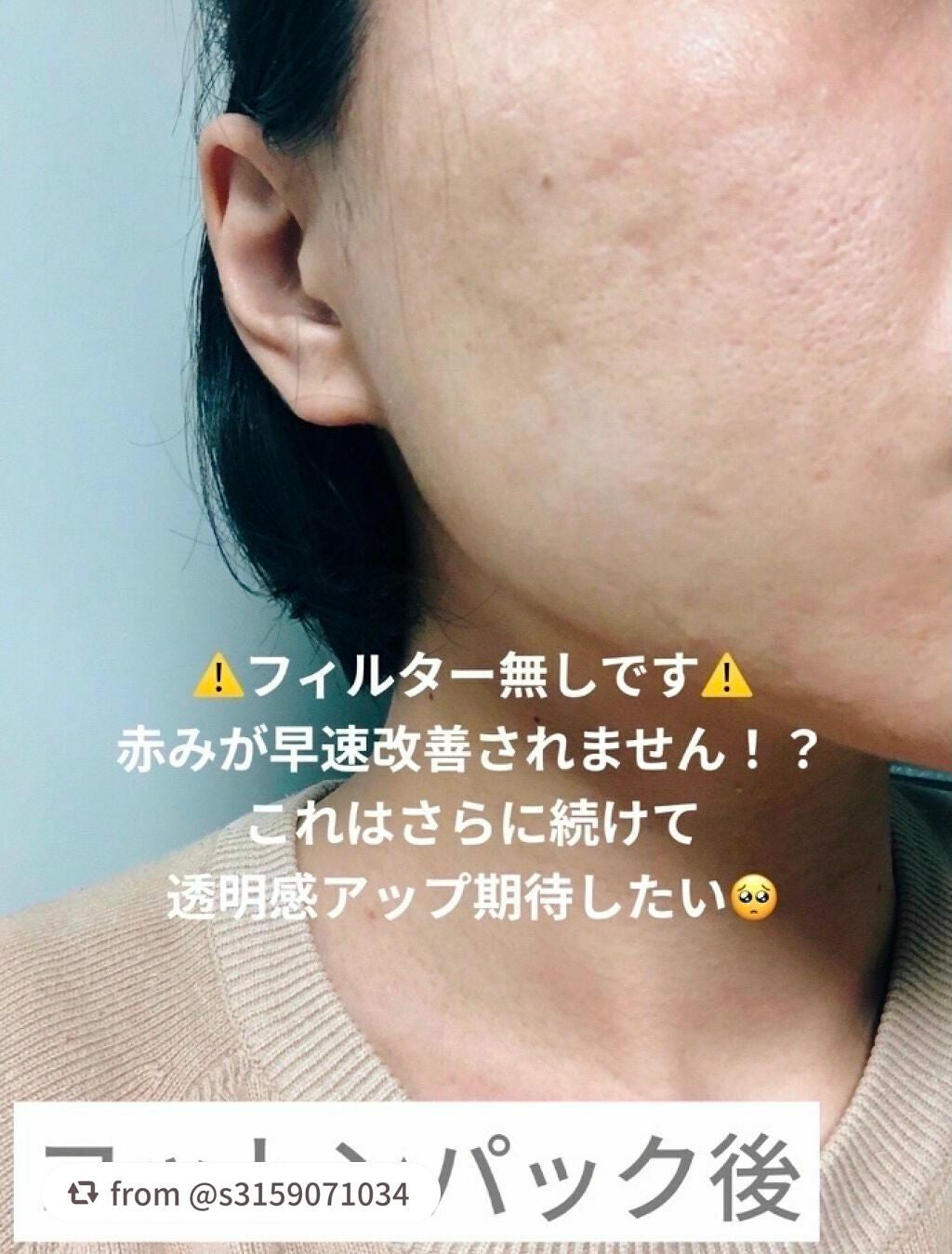 オーガニアンス ウォータリー エッセンス/primera/化粧水を使ったクチコミ(4枚目)