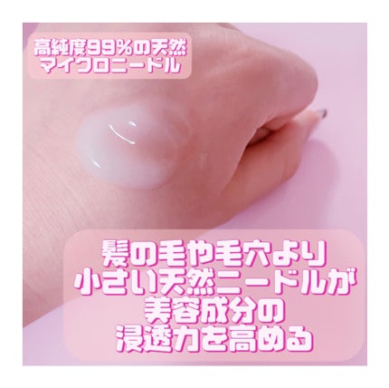 リードルショット300/VT/美容液を使ったクチコミ(2枚目)