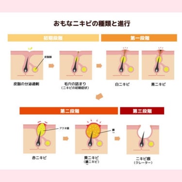 ハトムギ化粧水(ナチュリエ スキンコンディショナー R )/ナチュリエ/化粧水を使ったクチコミ（2枚目）