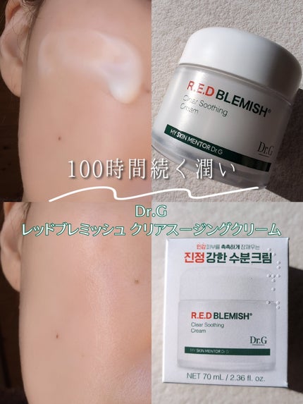 レッドブレミッシュ クリアスージングクリーム/Dr.G/フェイスクリームを使ったクチコミ(1枚目)
