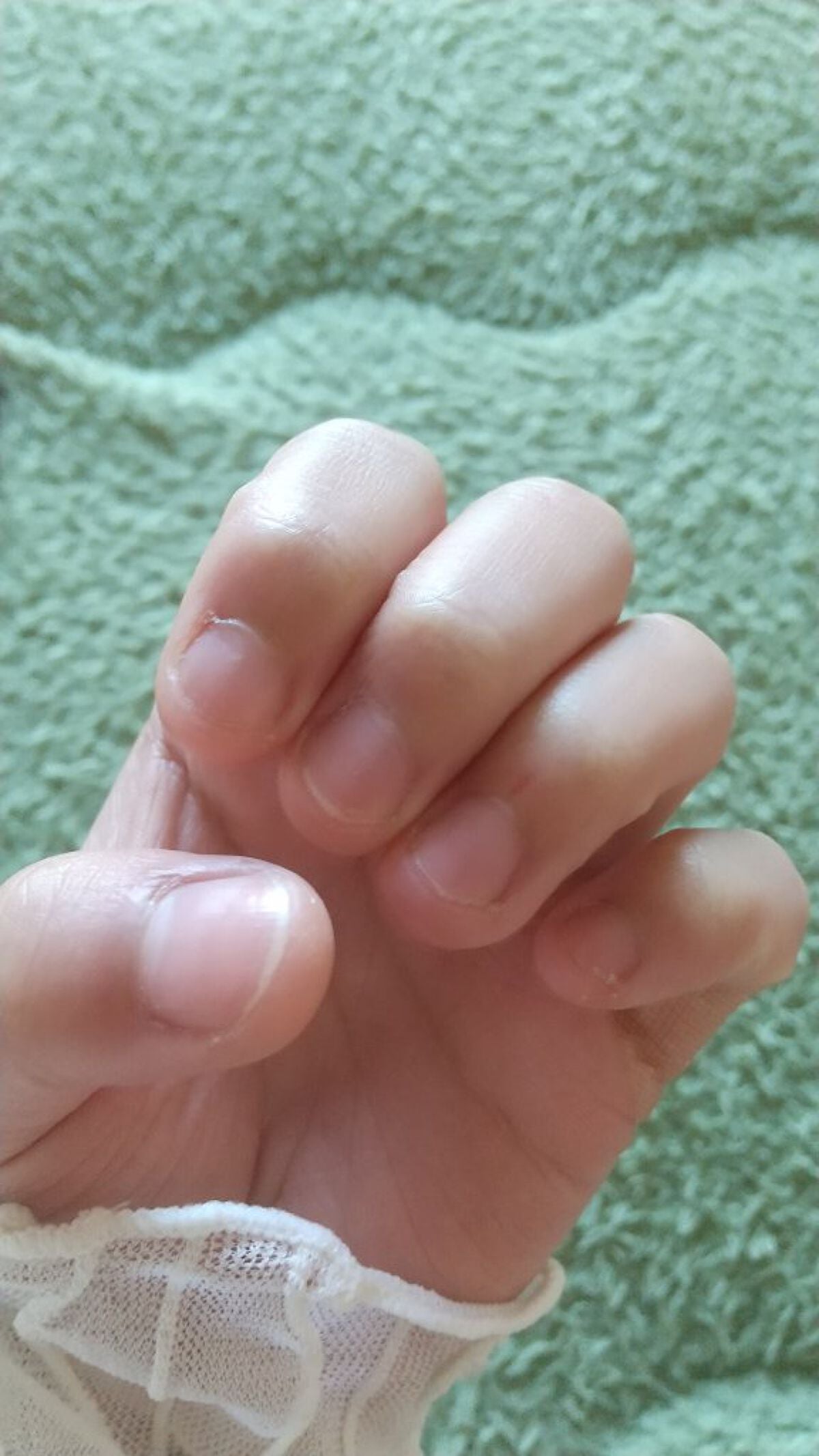 Aika. on LIPS 「1枚目左2枚目右です!結構久々投稿なんですけど少し伸びてきまし..」(1枚目)