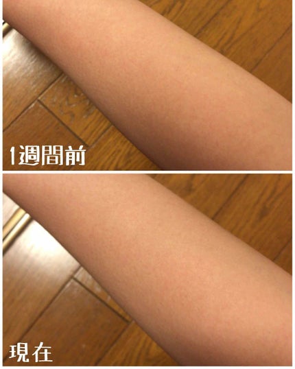 DHC ビタミンCハードカプセル/DHC/美容サプリメントを使ったクチコミ(2枚目)