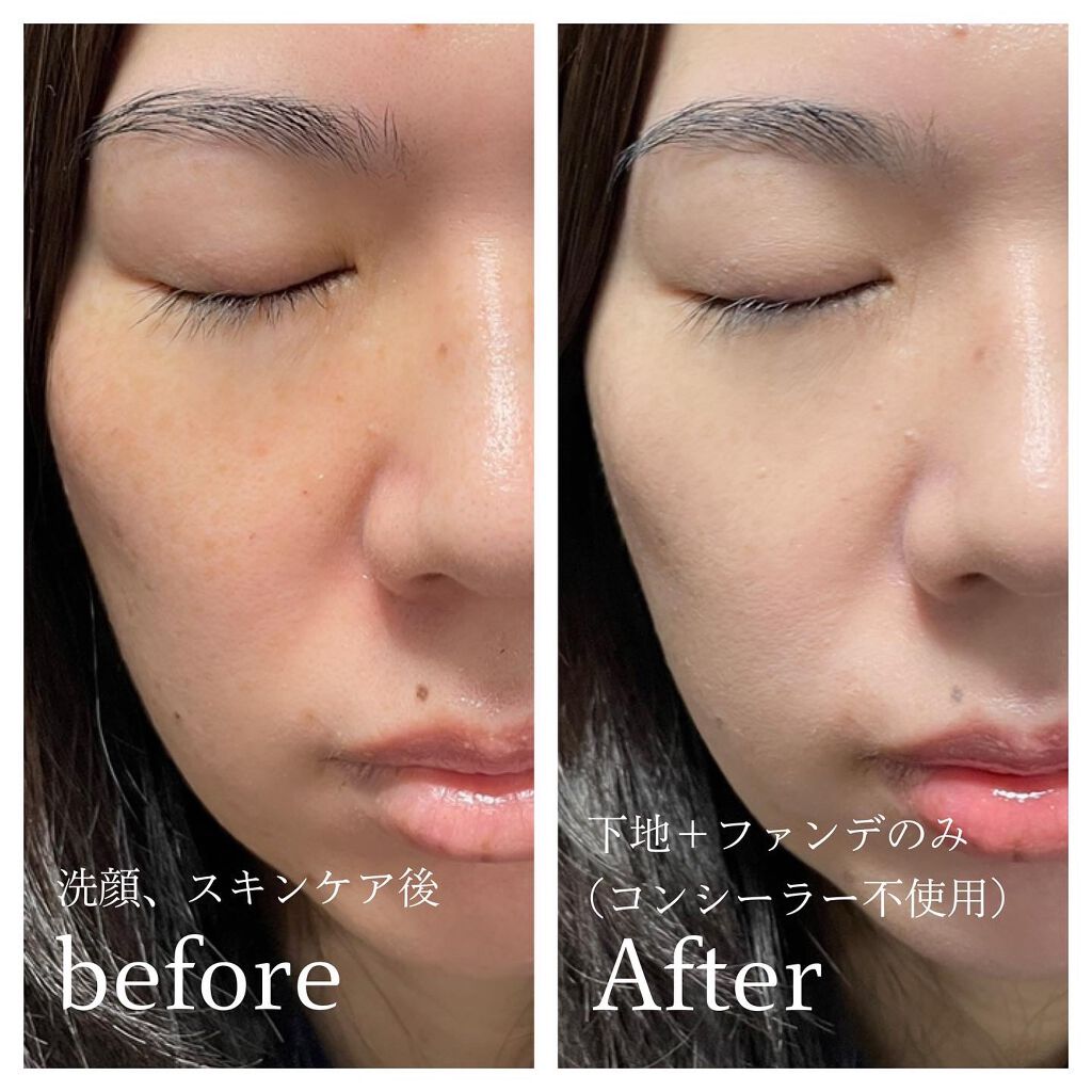 【旧】ディオールスキン フォーエヴァー クッション/Dior/クッションファンデーションを使ったクチコミ(4枚目)