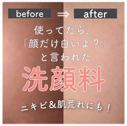 薬用クレンジング洗顔 N/なめらか本舗/洗顔フォームを使ったクチコミ(1枚目)