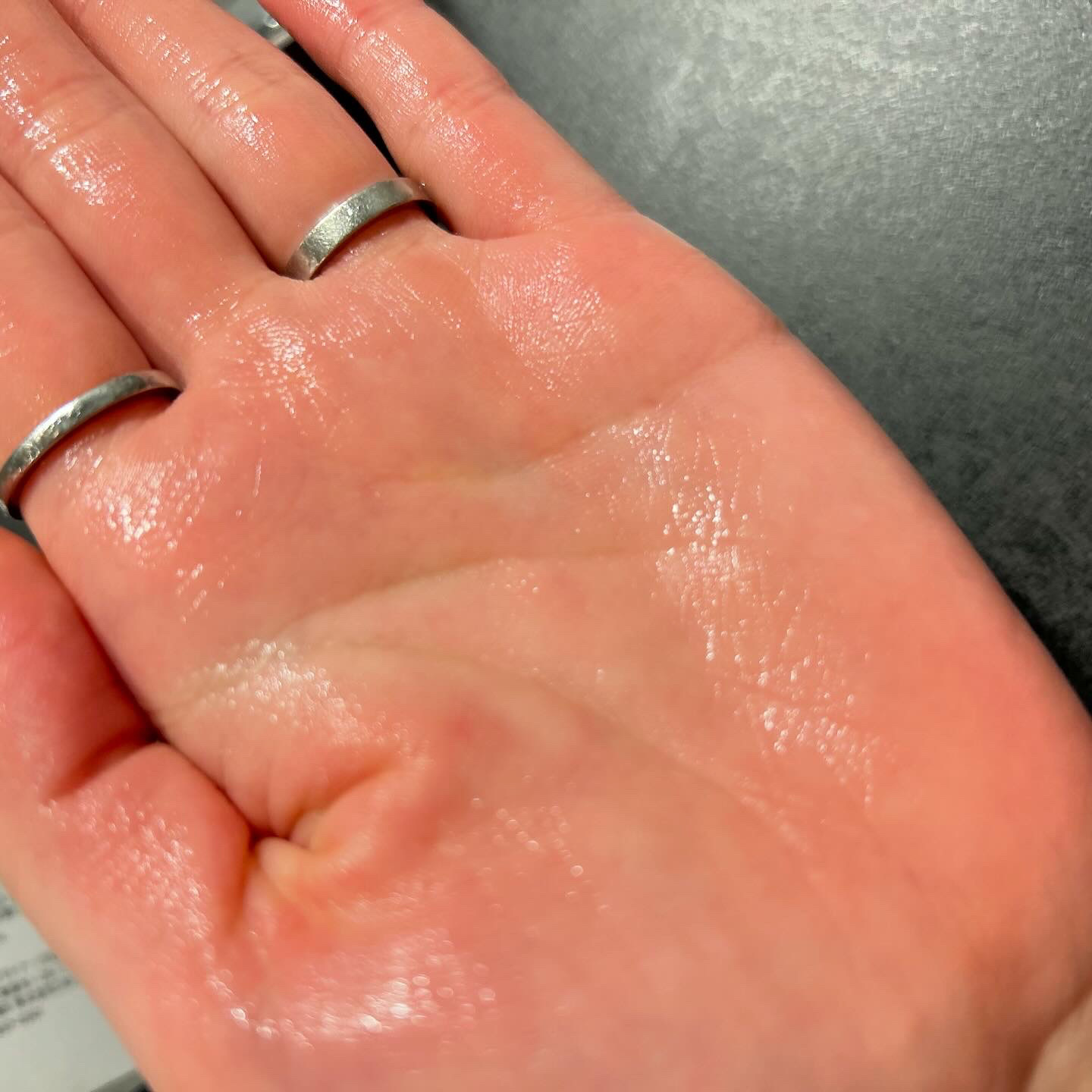 ドクダミ 77 スージングトナー/Anua/化粧水を使ったクチコミ（3枚目）