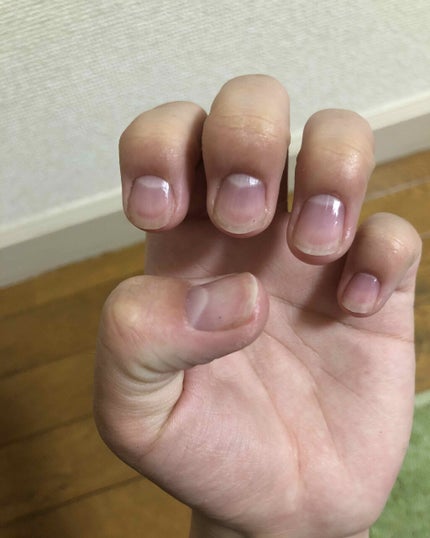 ネイルベッドオイル/アンドネイル/ネイルオイル・トリートメントを使ったクチコミ(1枚目)