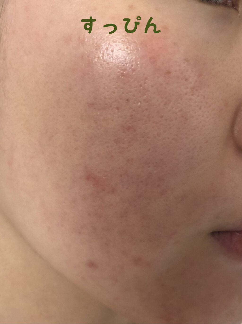 VT コラーゲンパクト/VT/クリーム・エマルジョンファンデーションを使ったクチコミ（2枚目）