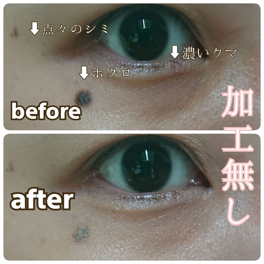 シミ隠しマジックパレット/シミウス/パレットコンシーラーを使ったクチコミ(4枚目)