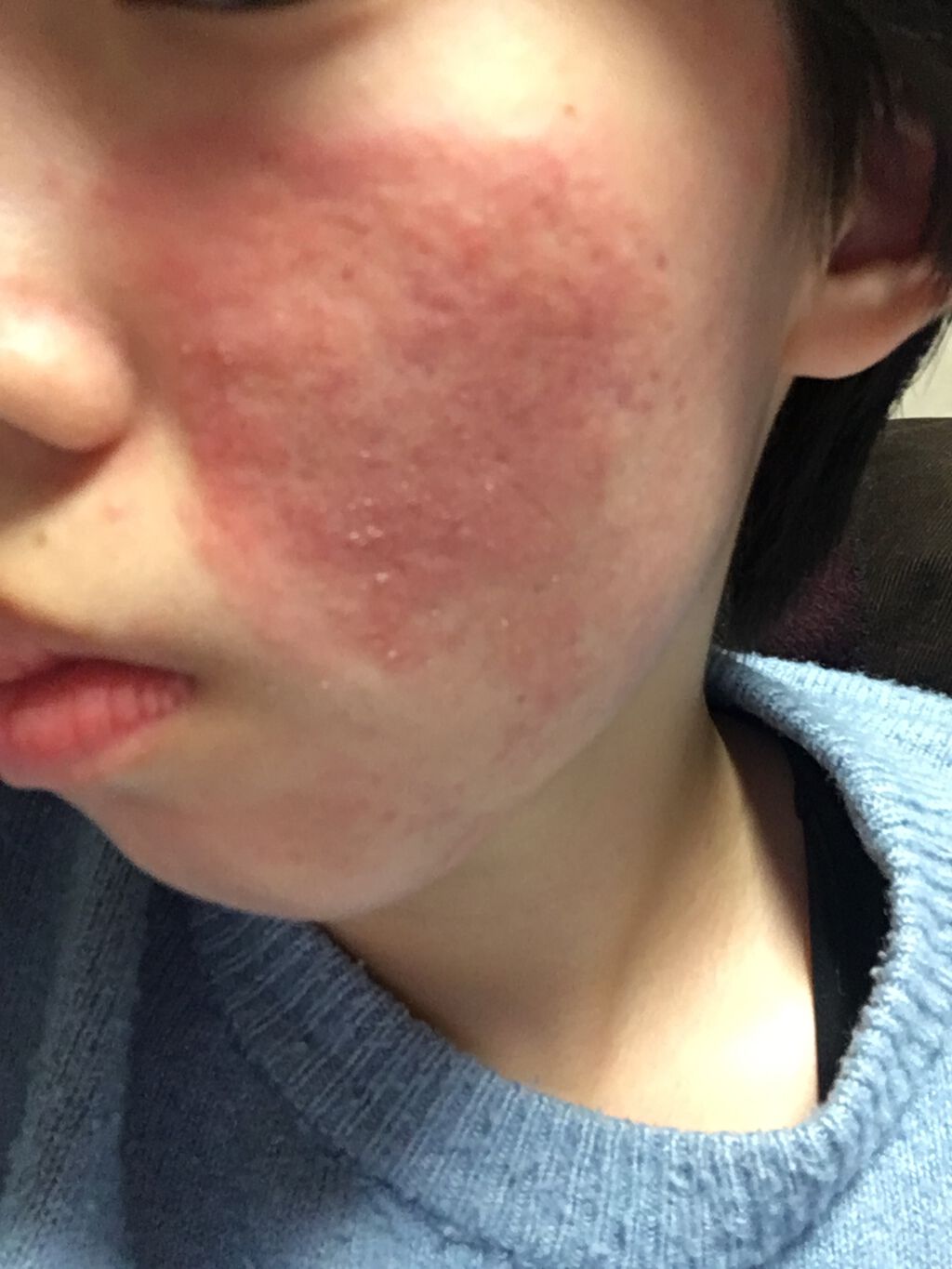 なつみ on LIPS 「今回はペビオゲルについてです。できるだけ手短に行きたいと思いま..」(3枚目)