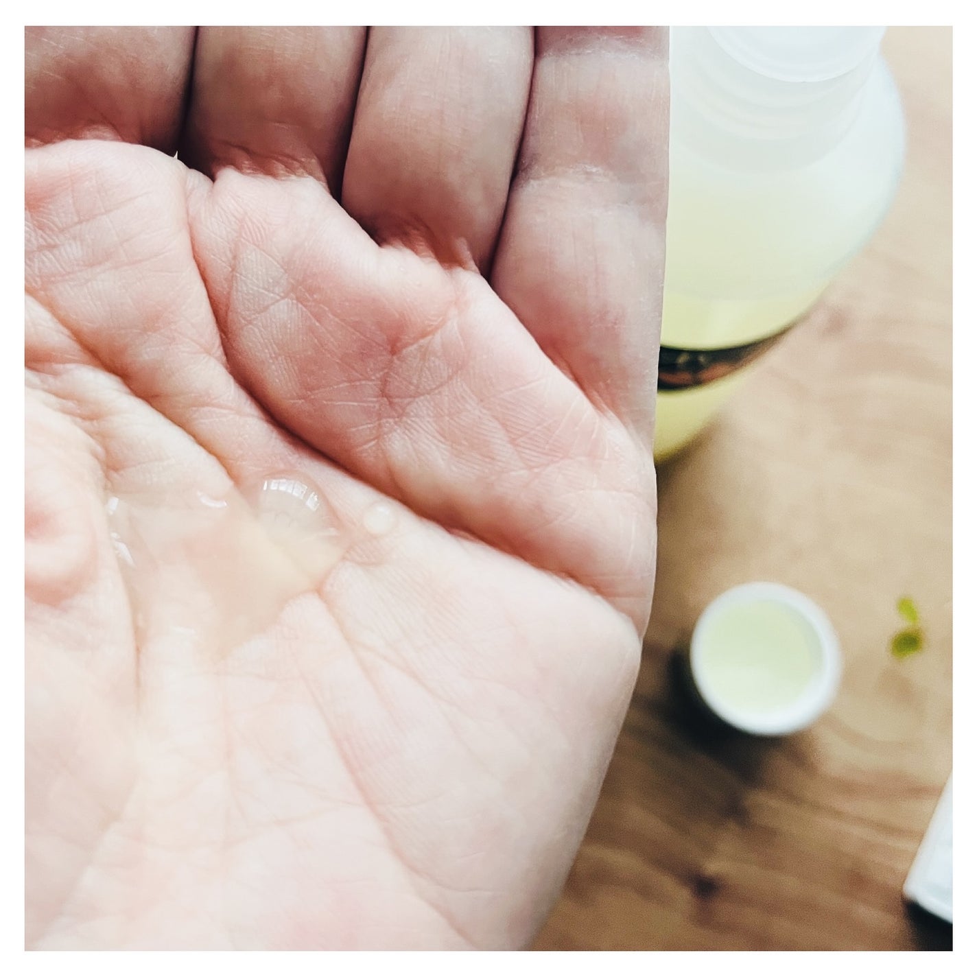 れんげ化粧水/れんげ研究所/化粧水を使ったクチコミ(5枚目)