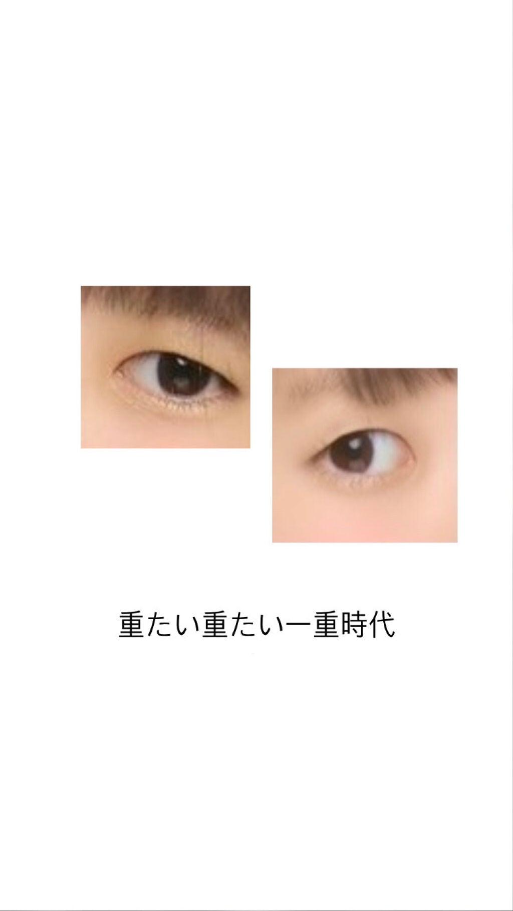 アイビューティー フィクサー WP/アストレア ヴィルゴ/二重まぶた用アイテムを使ったクチコミ(1枚目)