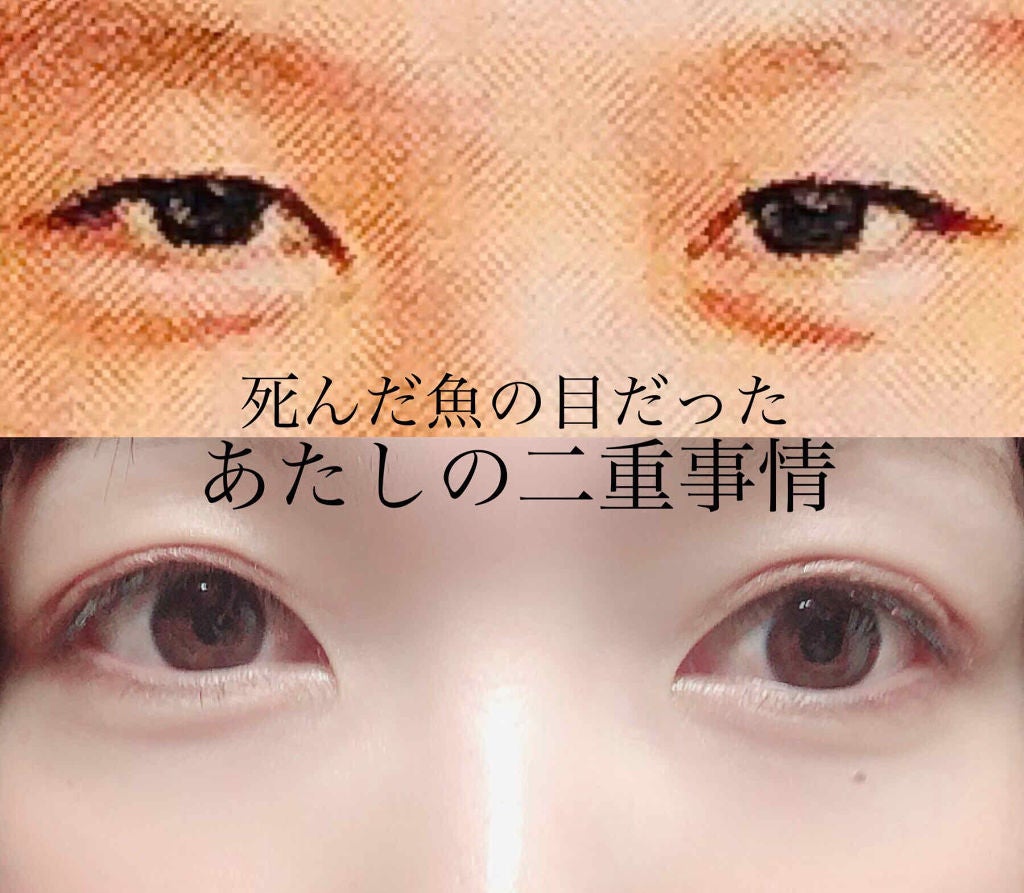 のびーるアイテープ(絆創膏タイプ、レギュラー)/DAISO/二重まぶた用アイテムを使ったクチコミ(1枚目)