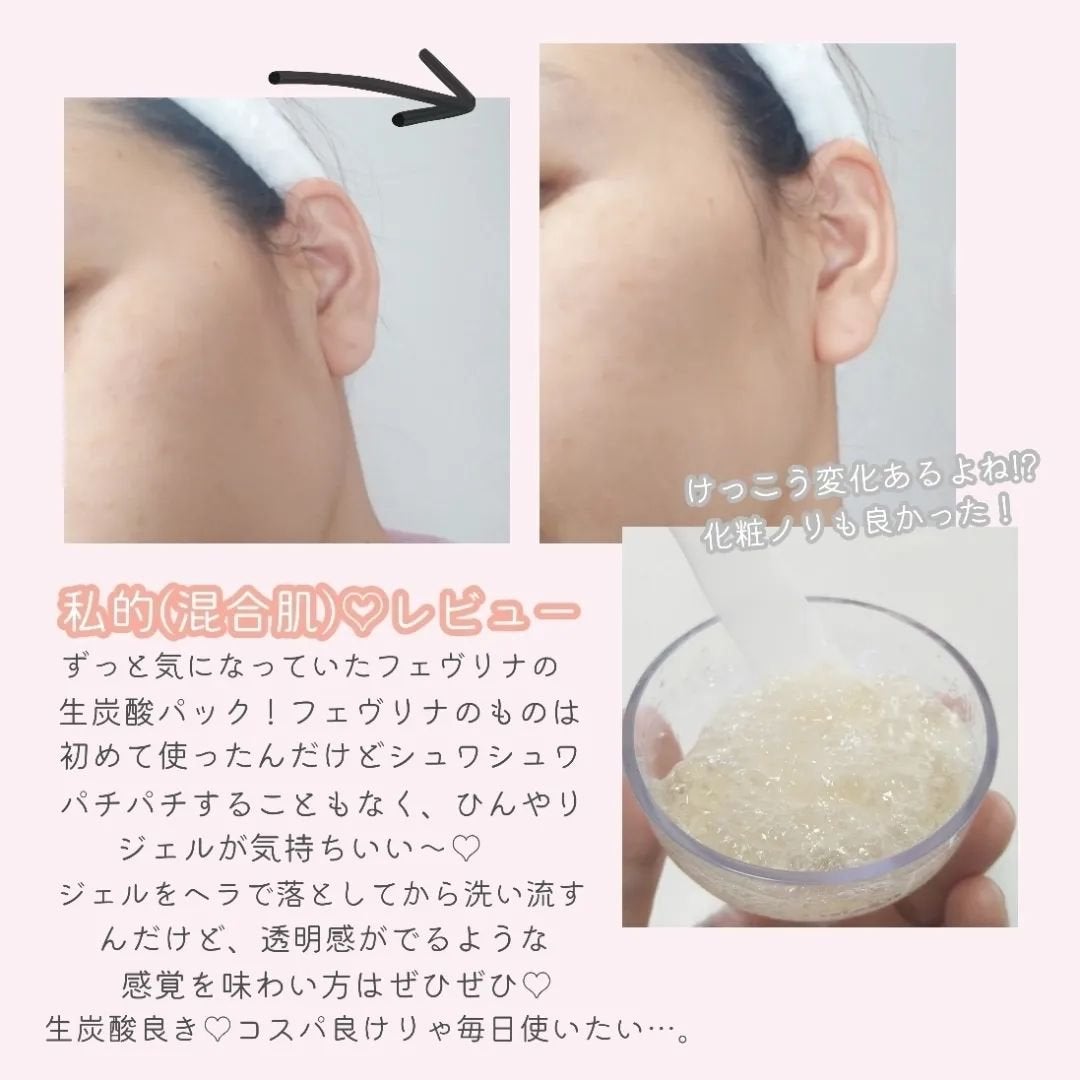 炭酸パックプレミアム/フェヴリナ/洗い流すパック・マスクを使ったクチコミ(5枚目)