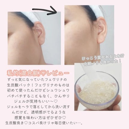 炭酸パックプレミアム/フェヴリナ/洗い流すパック・マスクを使ったクチコミ(5枚目)