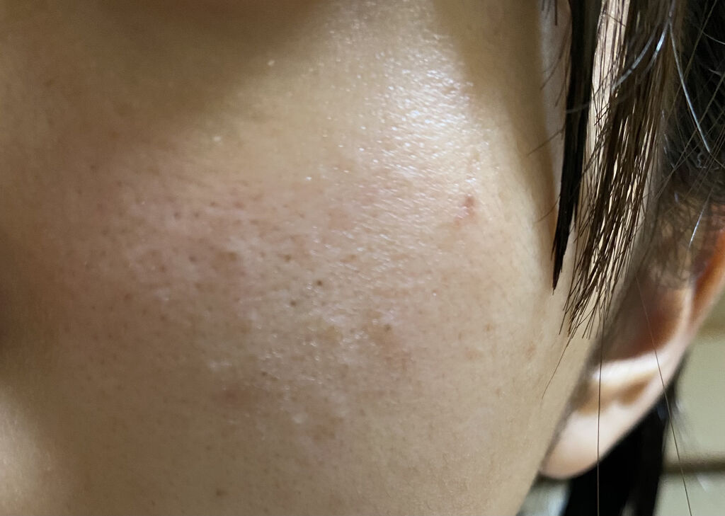 化粧水・敏感肌用・高保湿タイプ/無印良品/化粧水を使ったクチコミ（3枚目）