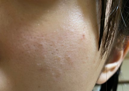 化粧水・敏感肌用・高保湿タイプ/無印良品/化粧水を使ったクチコミ(3枚目)