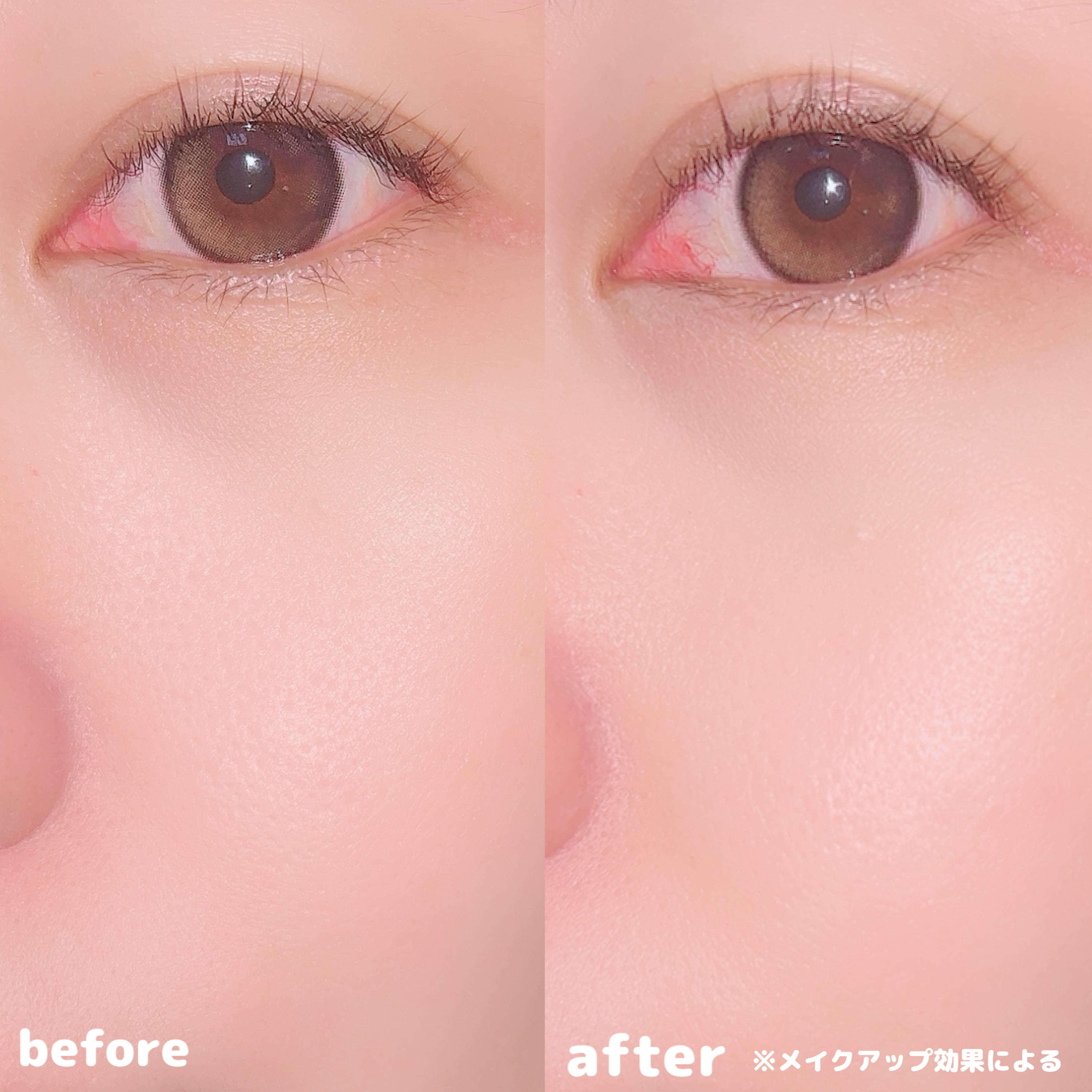 カリプソ マジックコンシーラー/カリプソ/コンシーラーを使ったクチコミ（2枚目）