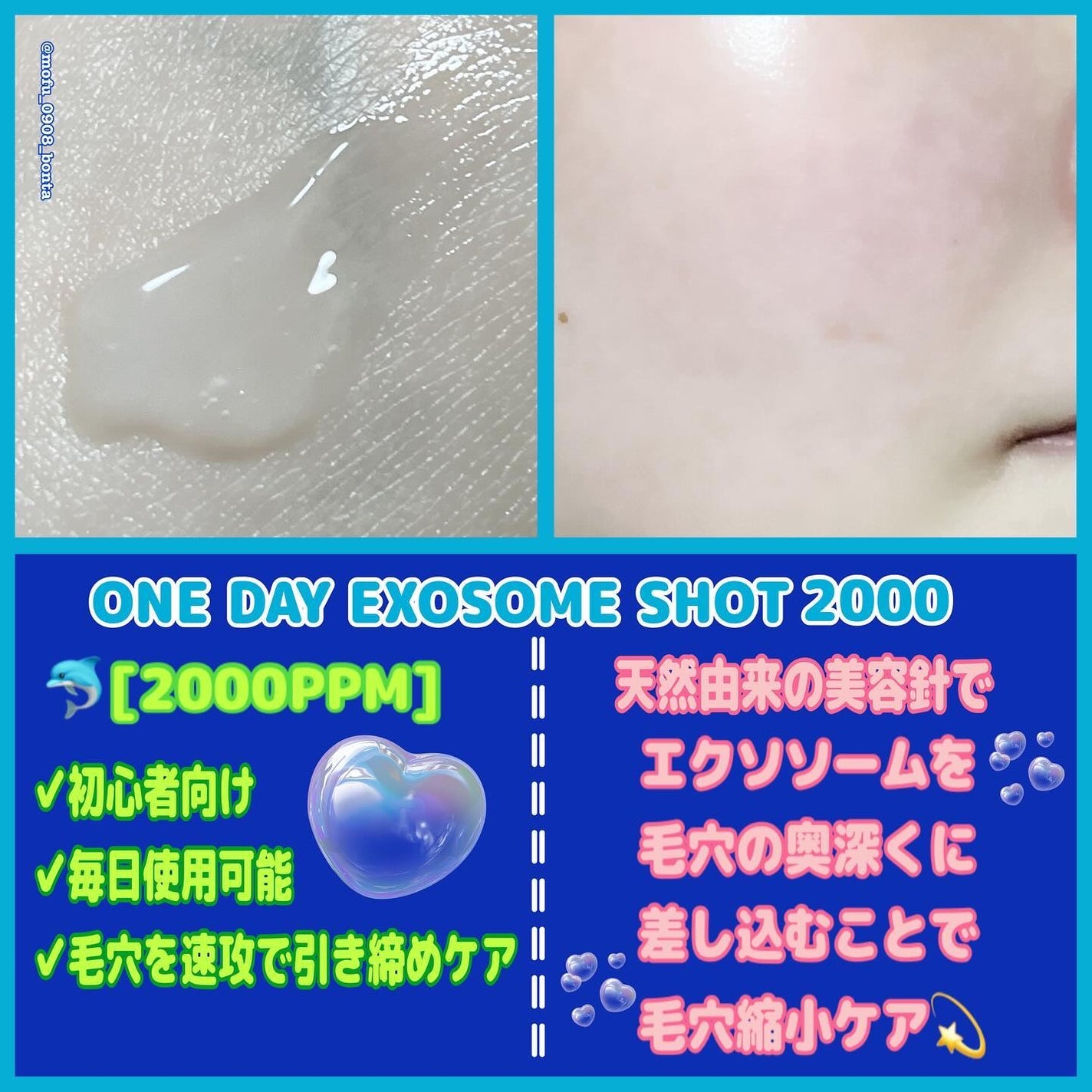 ゼロ毛穴パッド 2.0/MEDICUBE/トナーパッドを使ったクチコミ(5枚目)