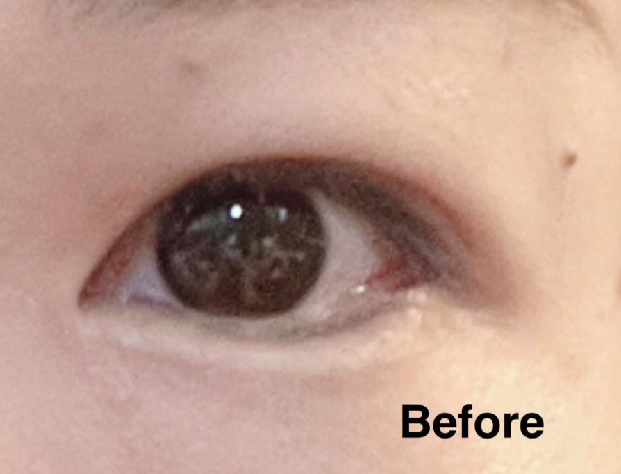 メッシュ アイテープ/shefun/二重まぶた用アイテムを使ったクチコミ（3枚目）