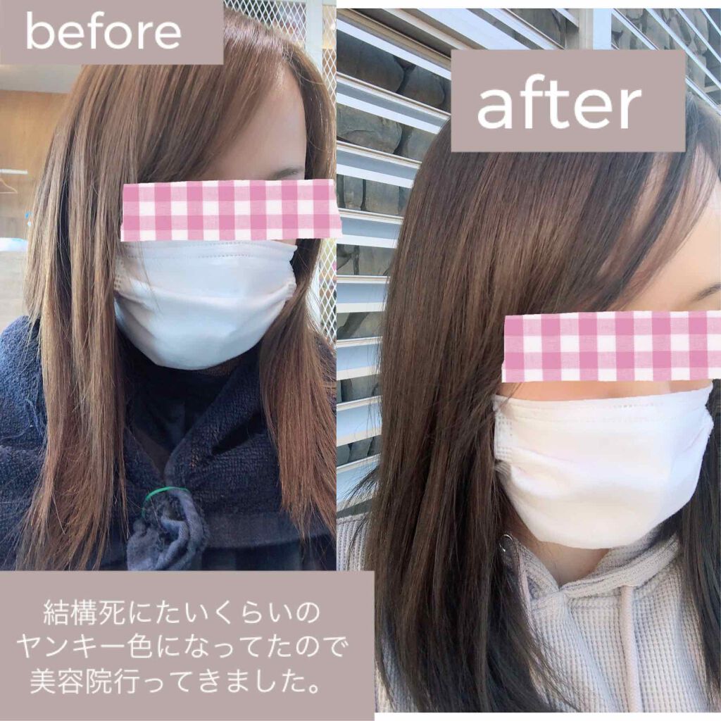 アセチノディープコア/ヤーマン/ボディケア美容家電を使ったクチコミ(5枚目)