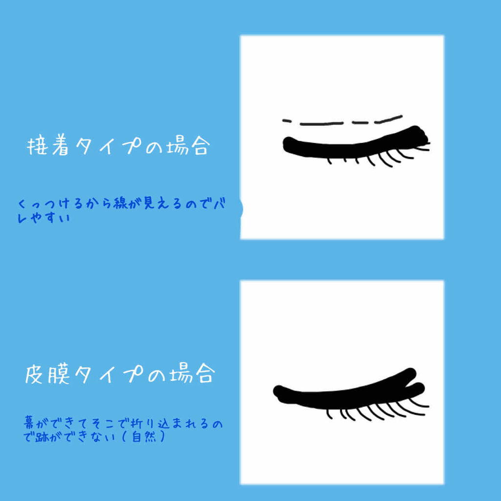 オリシキ アイリッドスキンフィルム		/D-UP/二重まぶた用アイテムを使ったクチコミ（2枚目）