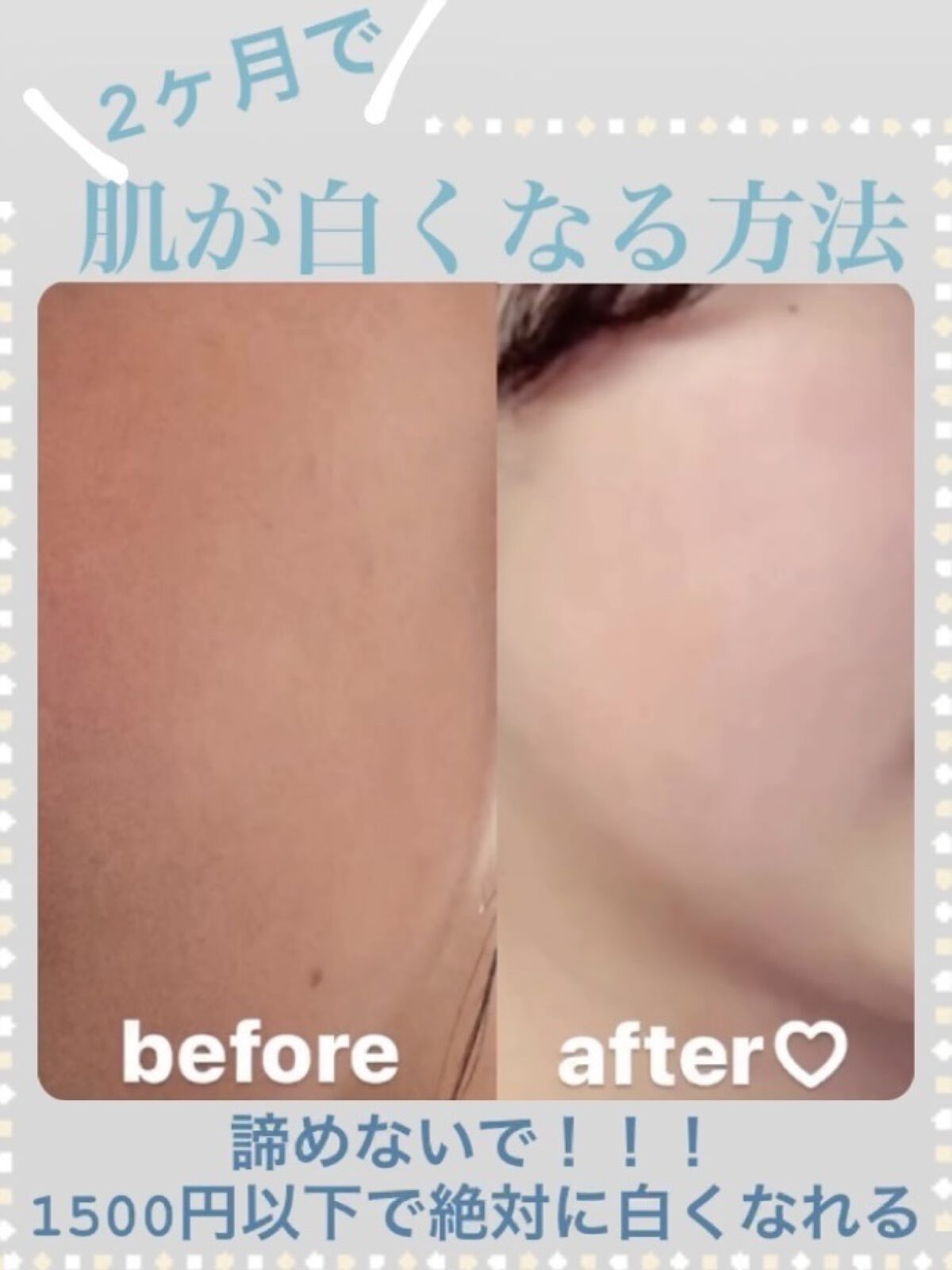 ハトムギ化粧水(ナチュリエ スキンコンディショナー R )/ナチュリエ/化粧水を使ったクチコミ（1枚目）