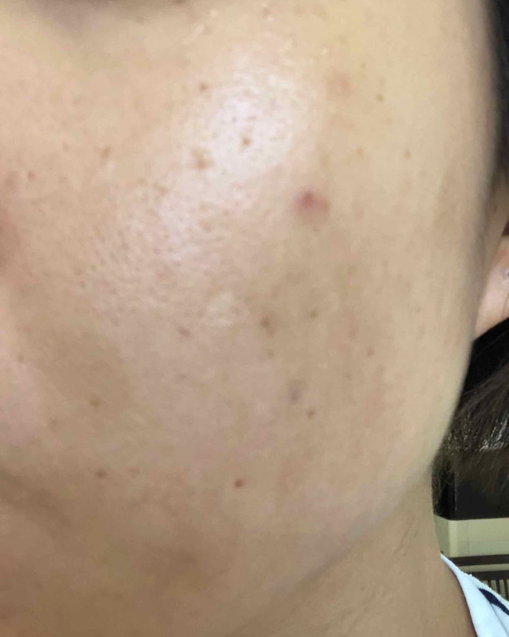 ハトムギ化粧水(ナチュリエ スキンコンディショナー R )/ナチュリエ/化粧水を使ったクチコミ（2枚目）