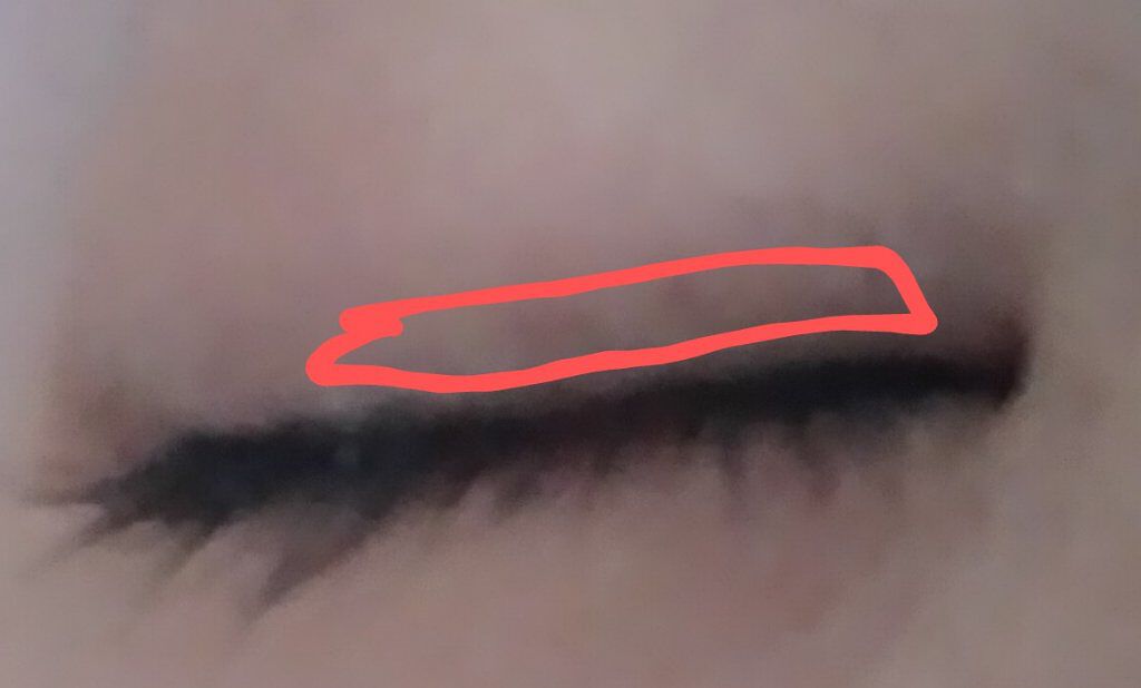 アイビューティー フィクサー WP/アストレア ヴィルゴ/二重まぶた用アイテムを使ったクチコミ（3枚目）