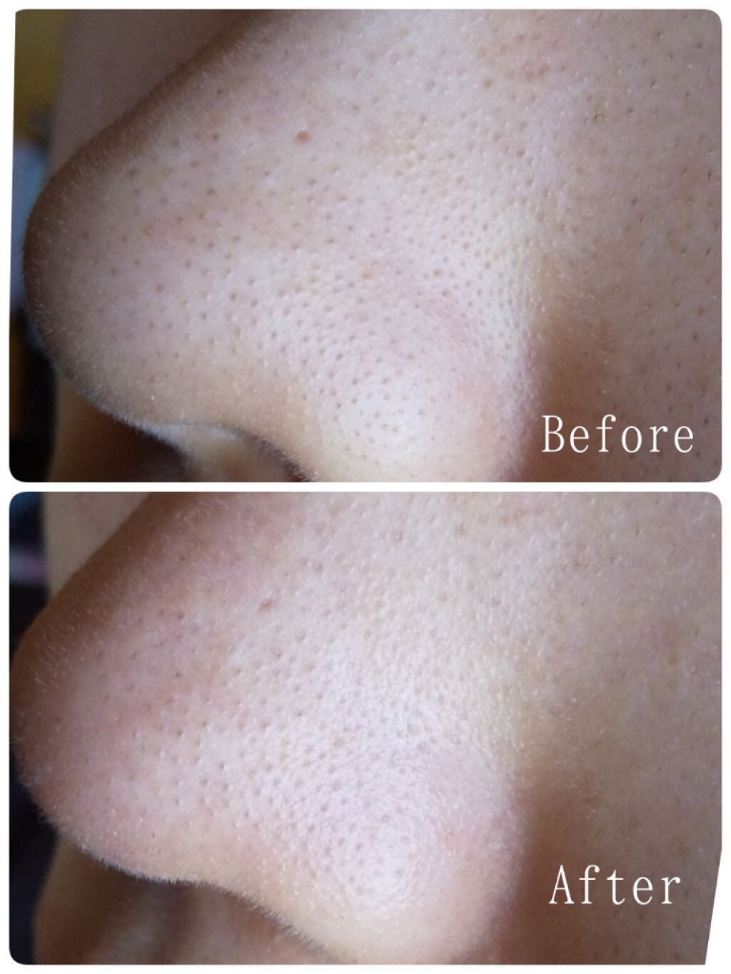 ピュアベール(医薬品)/プロペト/その他を使ったクチコミ(2枚目)