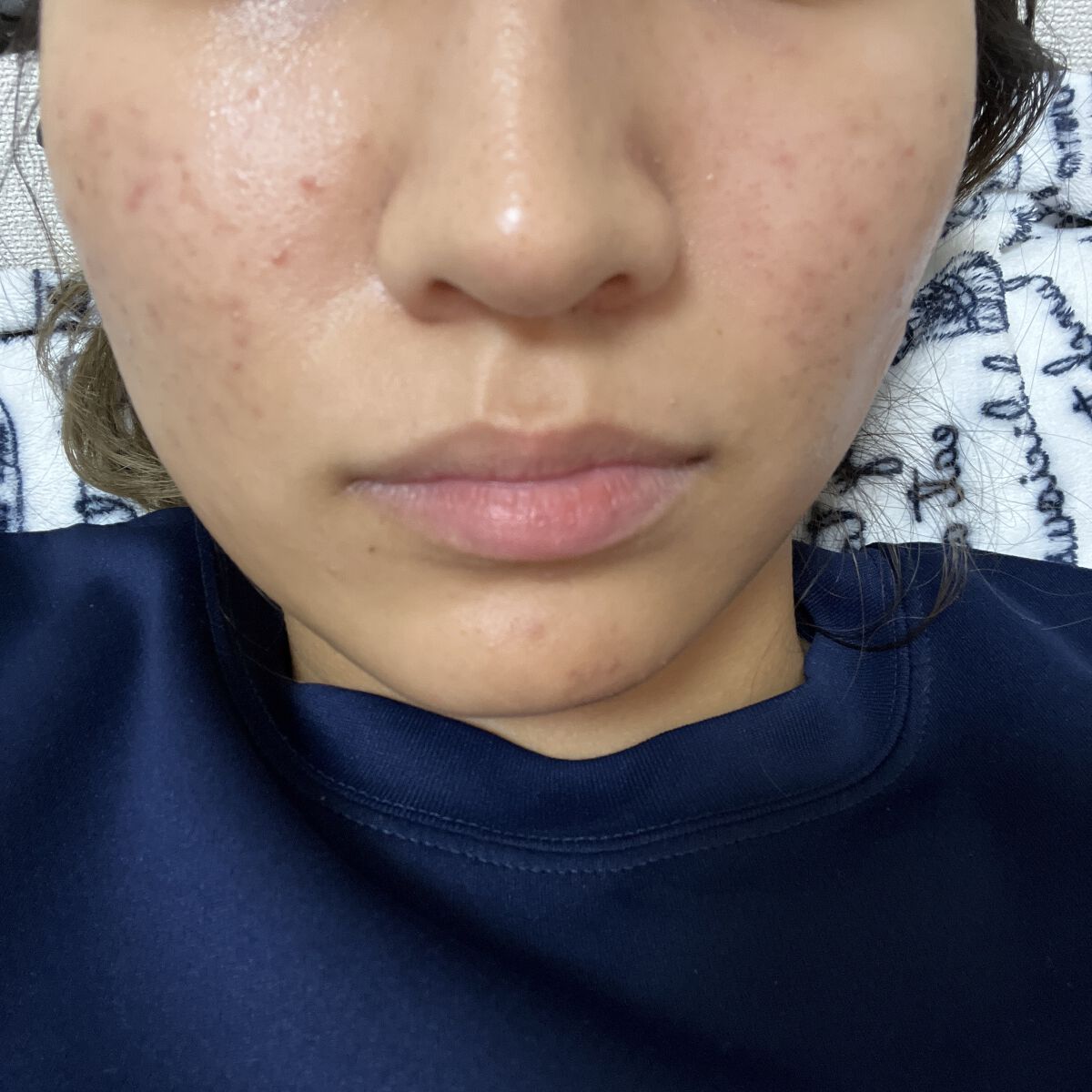 サンシビオ エイチツーオー D/ビオデルマ/クレンジングウォーターを使ったクチコミ（1枚目）