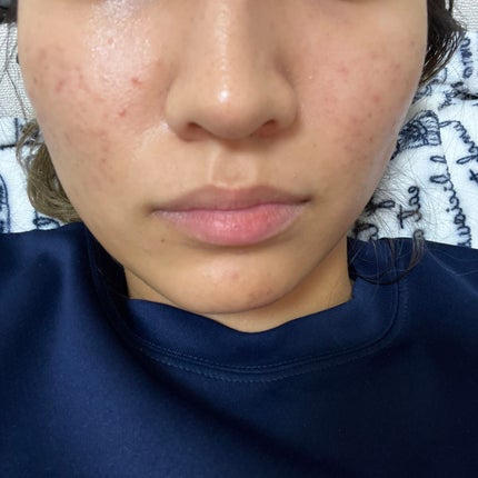 クレンジングバーム/ink./クレンジングバームを使ったクチコミ(1枚目)