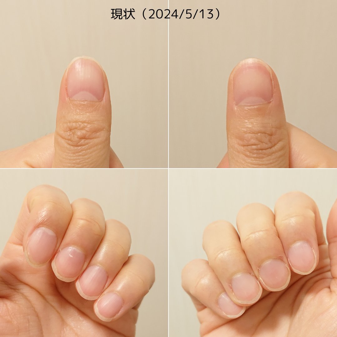 シア ネイルオイル 7.5ml【旧】/L'OCCITANE/ネイルオイル・トリートメントを使ったクチコミ（2枚目）