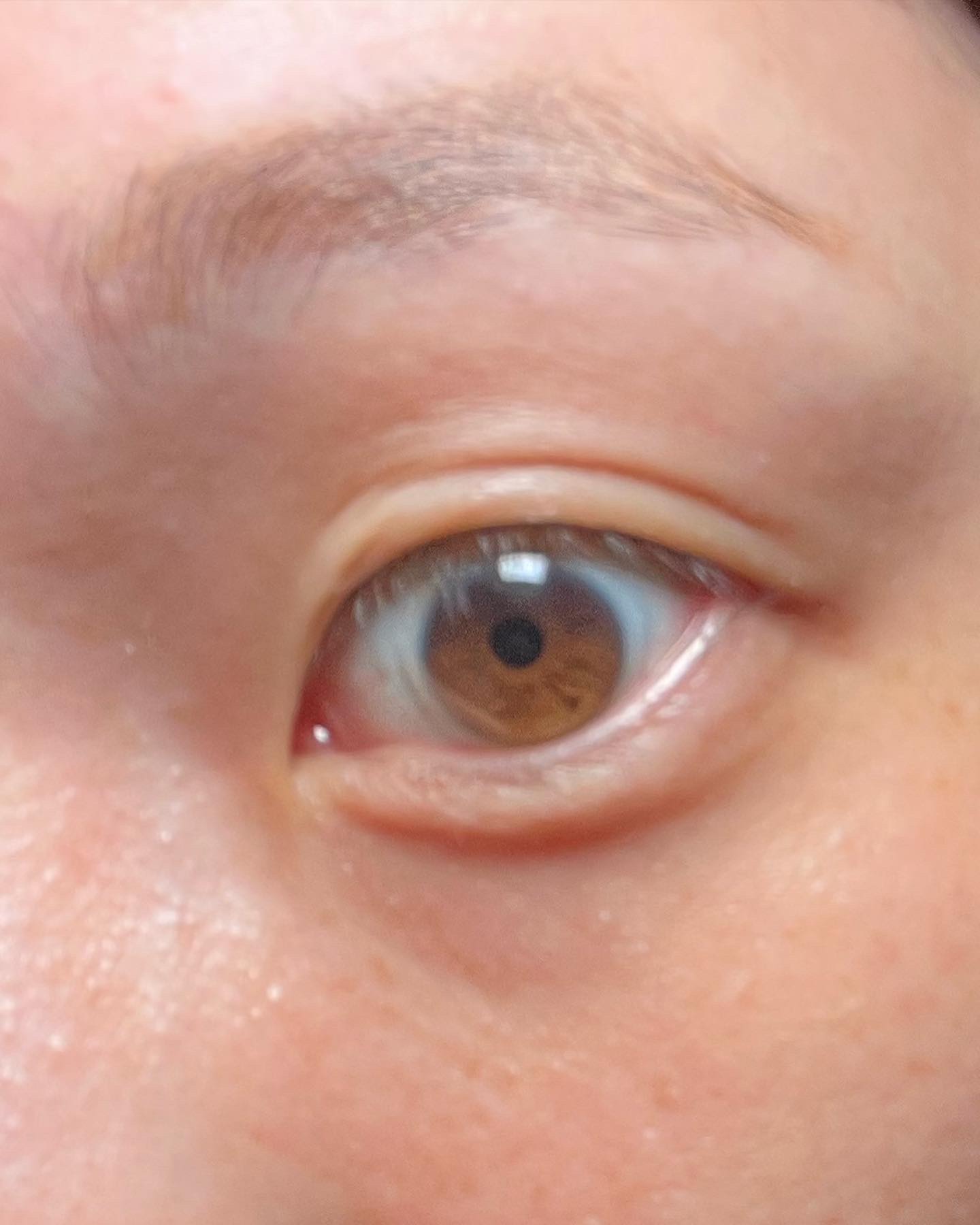 ハイブリッドフィルム/アイトーク/二重まぶた用アイテムを使ったクチコミ（3枚目）