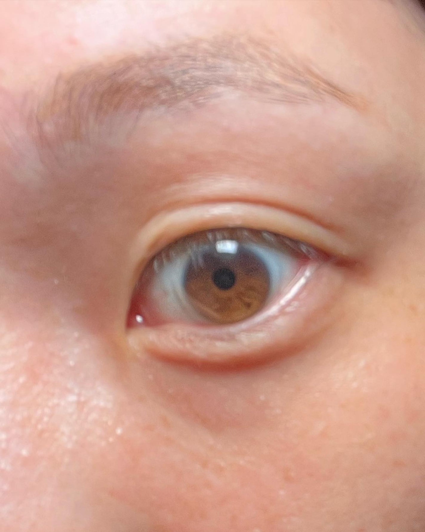 ハイブリッドフィルム/アイトーク/二重まぶた用アイテムを使ったクチコミ(3枚目)