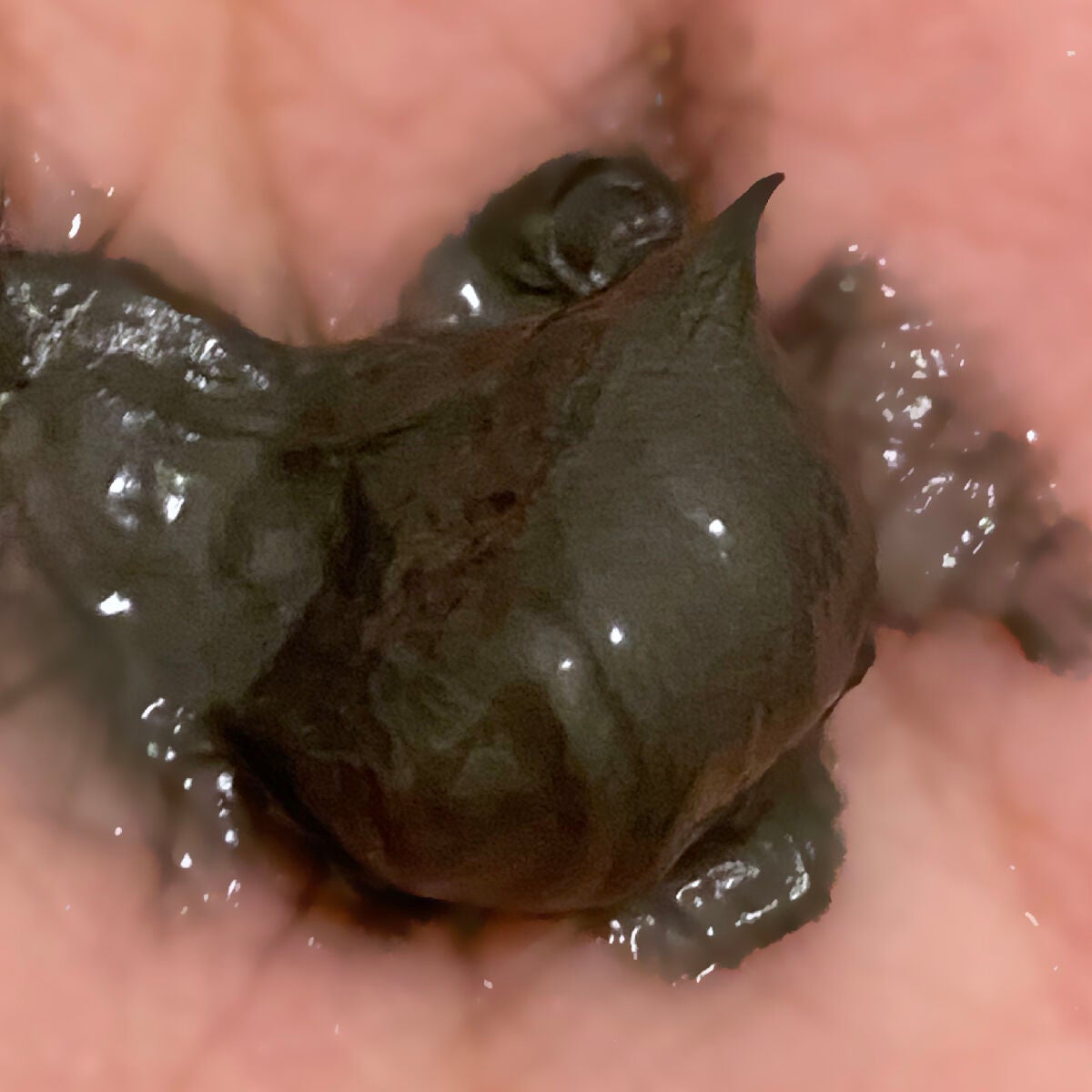 毛穴小町 テカリ源治 もちもちブラック洗顔/クリアターン/洗顔フォームを使ったクチコミ(2枚目)