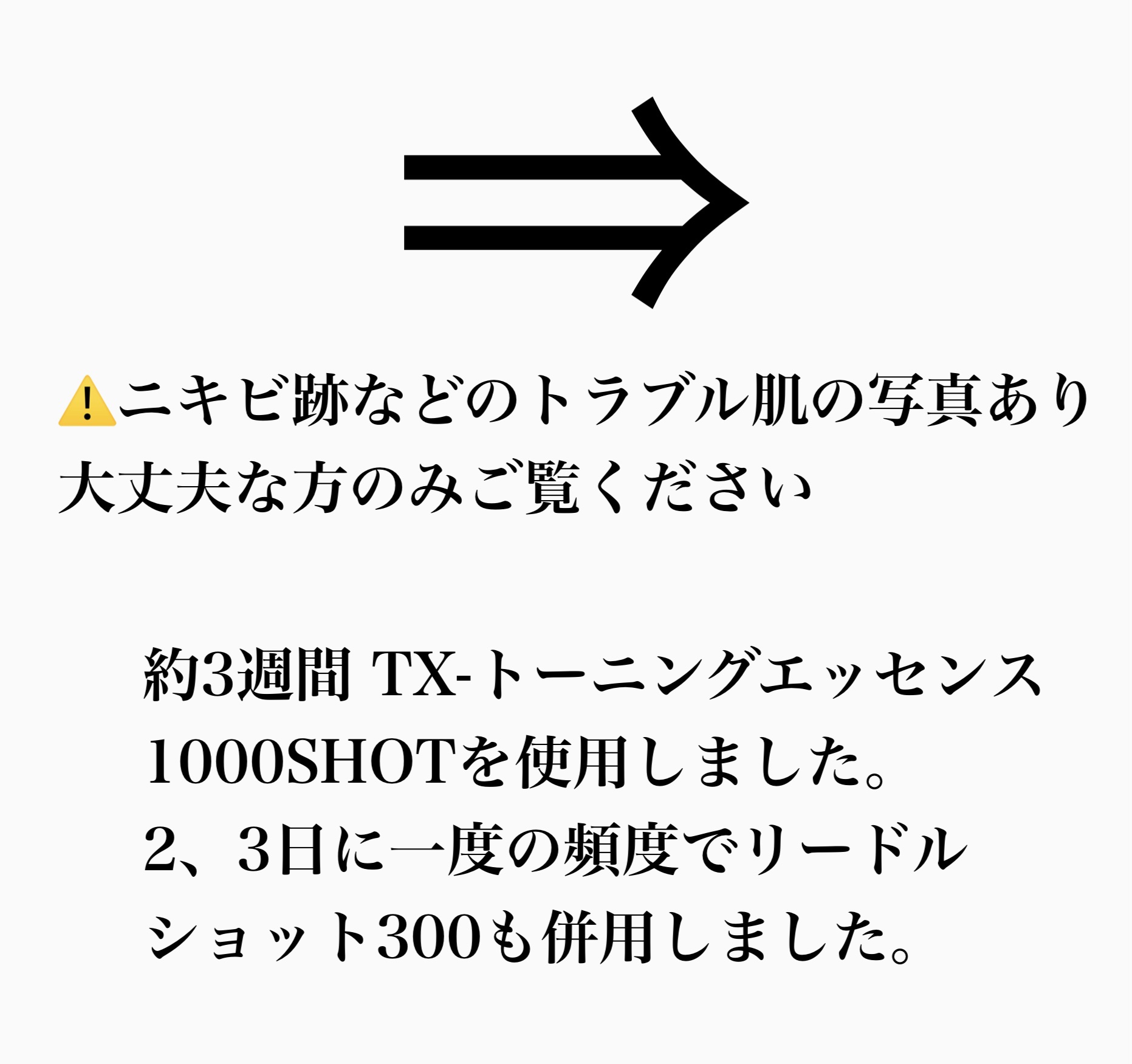 リードルショット300/VT/美容液を使ったクチコミ（3枚目）