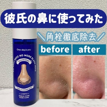 ◎One-day's you
P.Z. SSOC SSOC NO MORE BLACKHEAD
ノーモアブラックヘッド

今までに何度も投稿しているノーモアブラックヘッドですがこの凄さを皆さんにお届けし