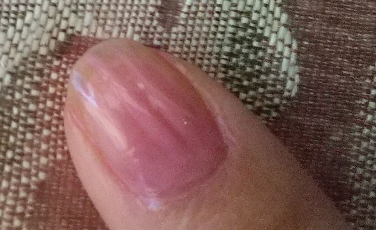 1Day密封ネイルケアパック/DAILY NAILLY/ネイルオイル・トリートメントを使ったクチコミ（2枚目）