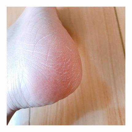 Dr.セーム 洗顔ミトン/アレトコレ/その他スキンケアグッズを使ったクチコミ(3枚目)