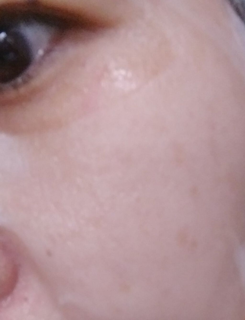 リバイバル ステムプラス/リッツ/美容液を使ったクチコミ(2枚目)