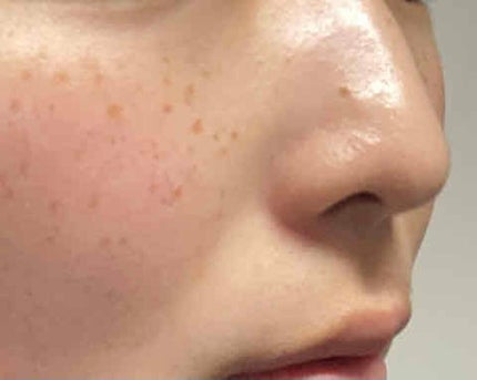 スポッツカバー ファウンデイション/SHISEIDO/クリームコンシーラーを使ったクチコミ(2枚目)