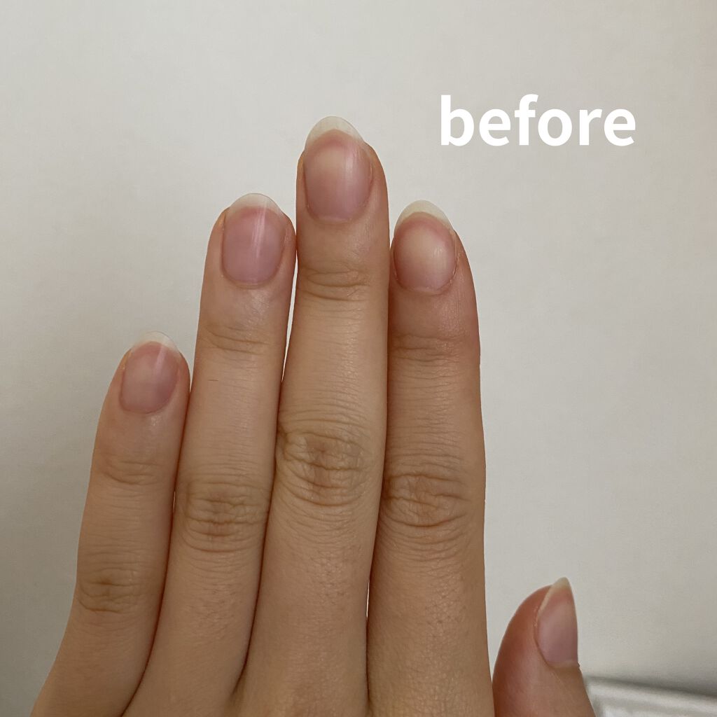 アロマキューティクルオイル/D-UP/ネイルオイル・トリートメントを使ったクチコミ（2枚目）