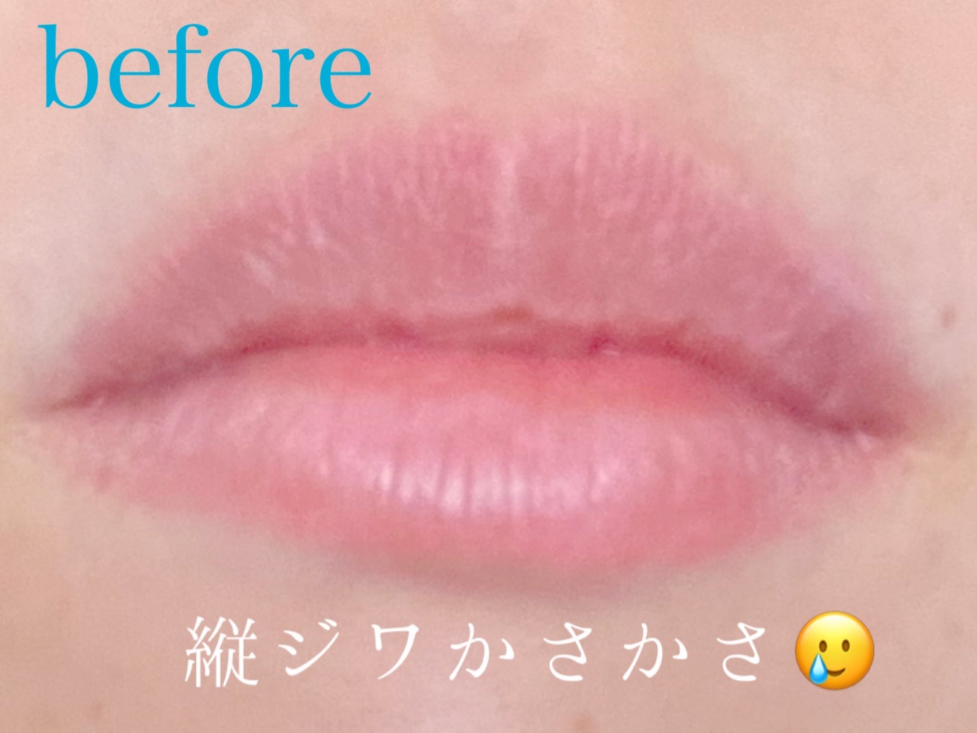 リップモイストエッセンス N/d プログラム/リップ美容液を使ったクチコミ(2枚目)