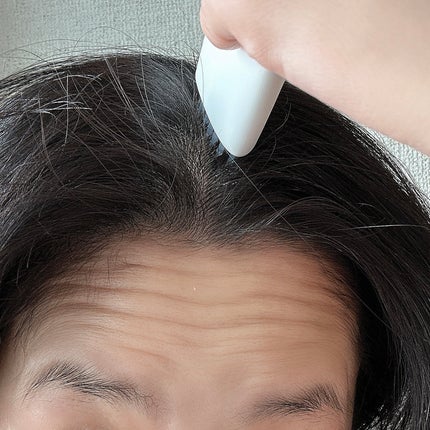 グローターン 100ml/リリーイブ/頭皮ローションを使ったクチコミ(4枚目)