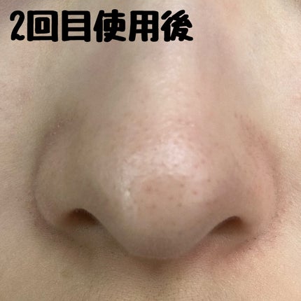 ノーモアブラックヘッド(ノーズピーリング)/One-day's you/スクラブ・ゴマージュを使ったクチコミ(4枚目)