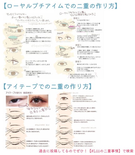のびーるアイテープ(絆創膏タイプ、レギュラー)/DAISO/二重まぶた用アイテムを使ったクチコミ(9枚目)