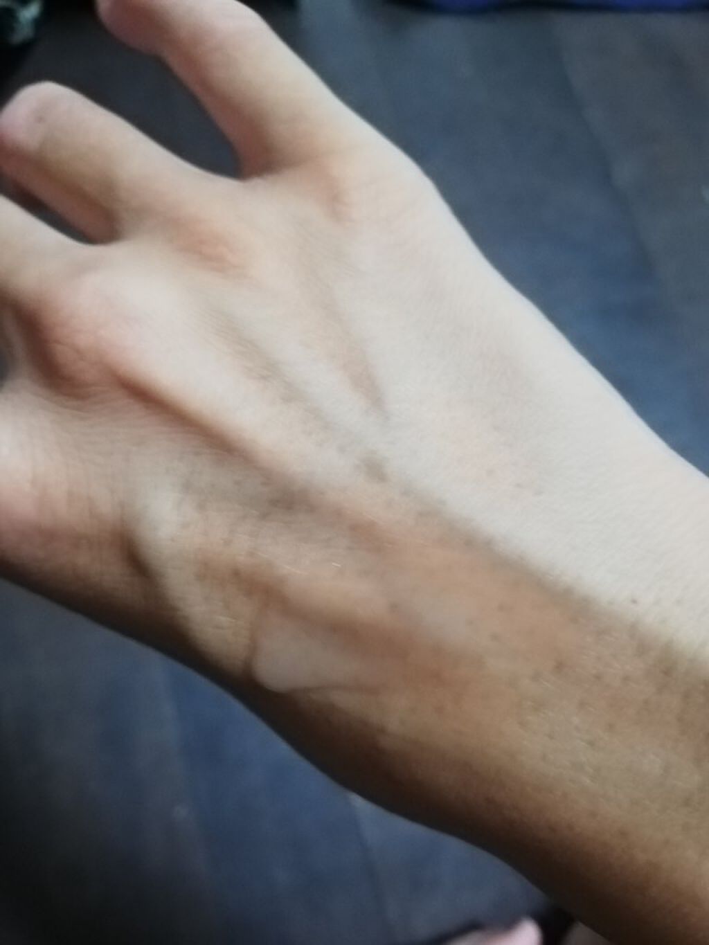 モイスチュア ローション/カルテHD/化粧水を使ったクチコミ（2枚目）