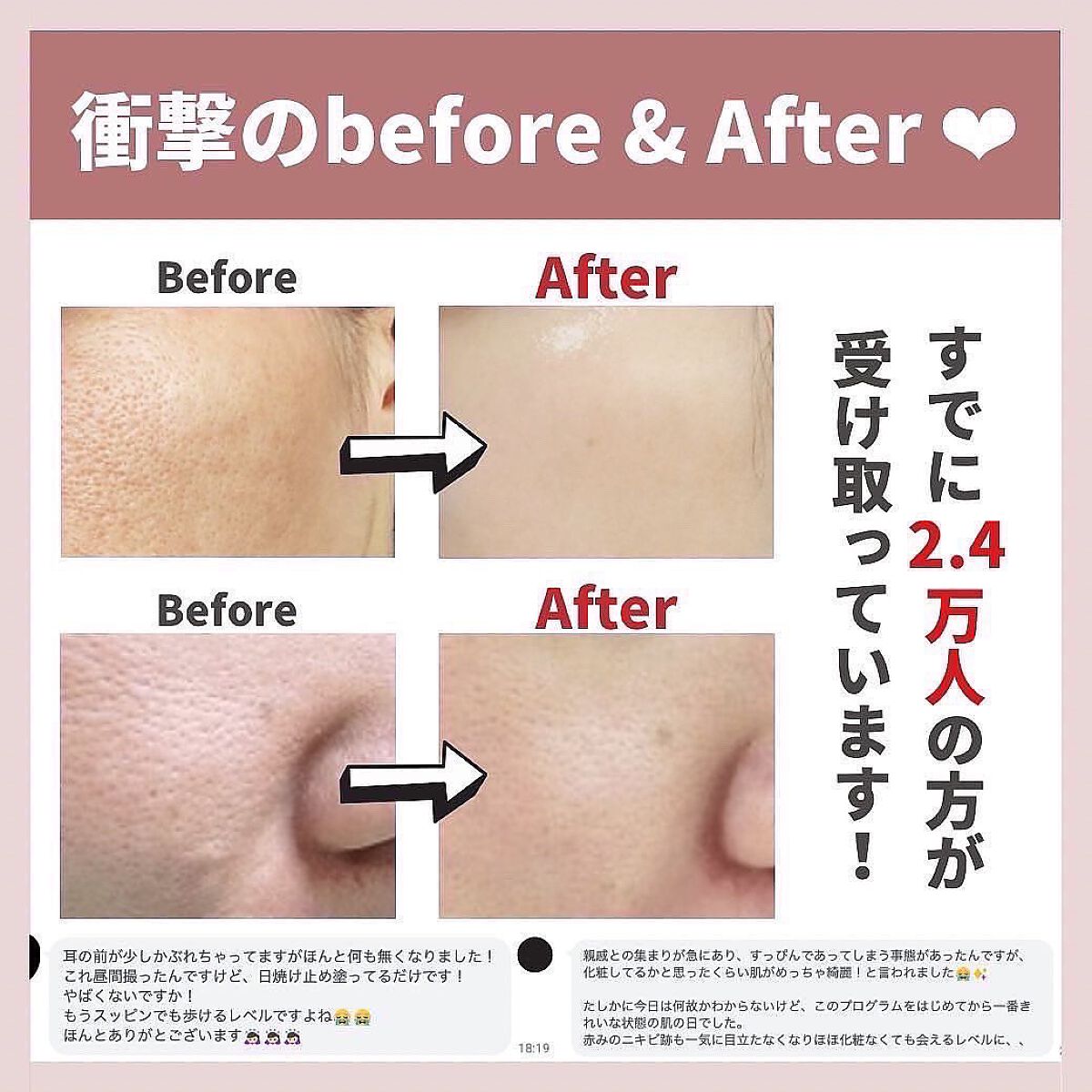 あなたの肌に合ったスキンケア💐コーくん先生 on LIPS 「1月中に毛穴の開きをなくしたい人だけ見てください。.あなたの毛..」(8枚目)